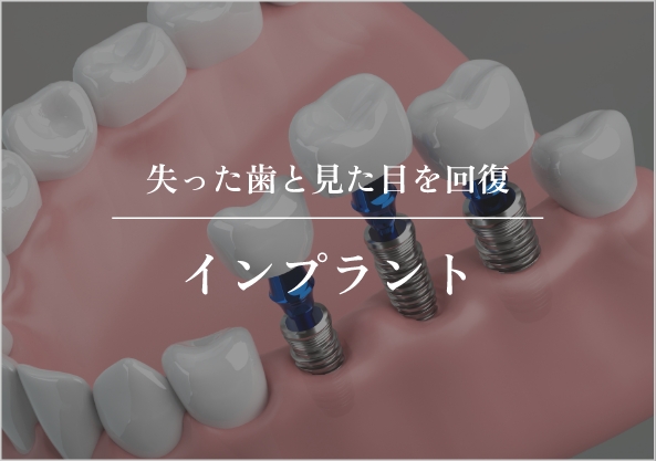 インプラント