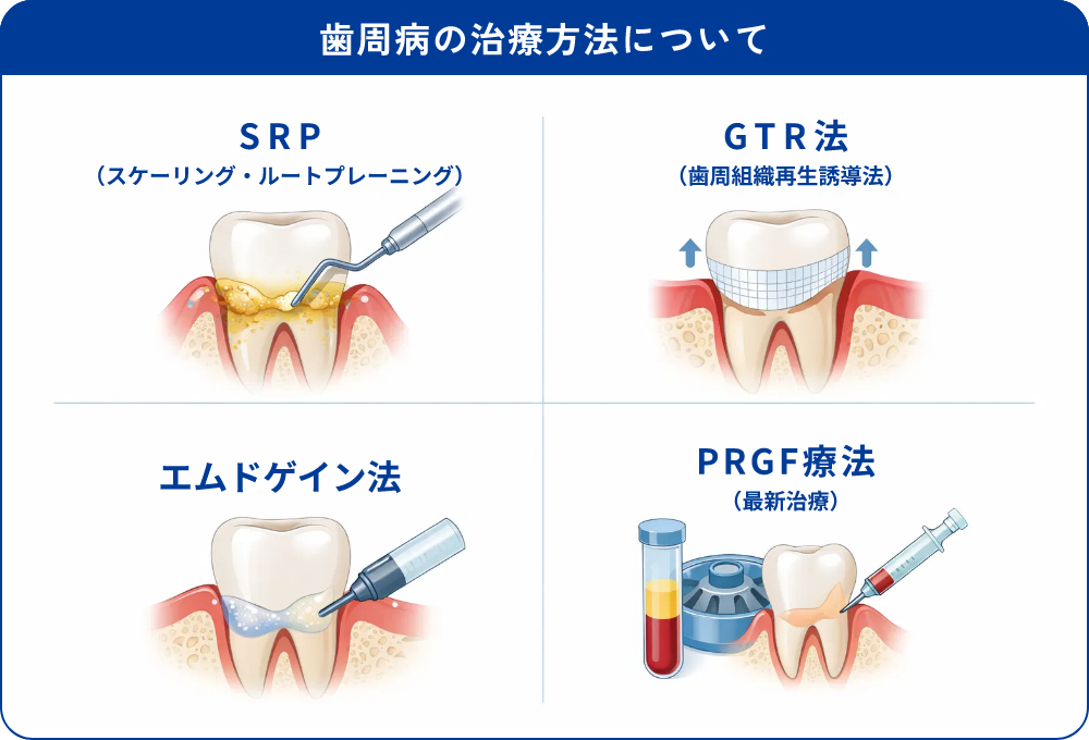 歯周病でもインプラント治療は可能か